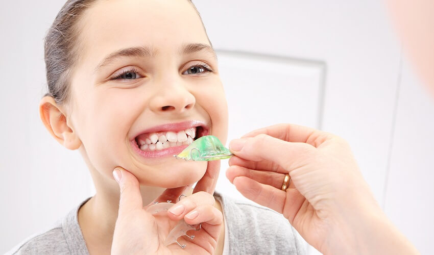 יישור שיניים 2