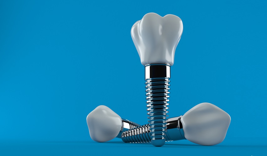 שתלים דנטלים_1